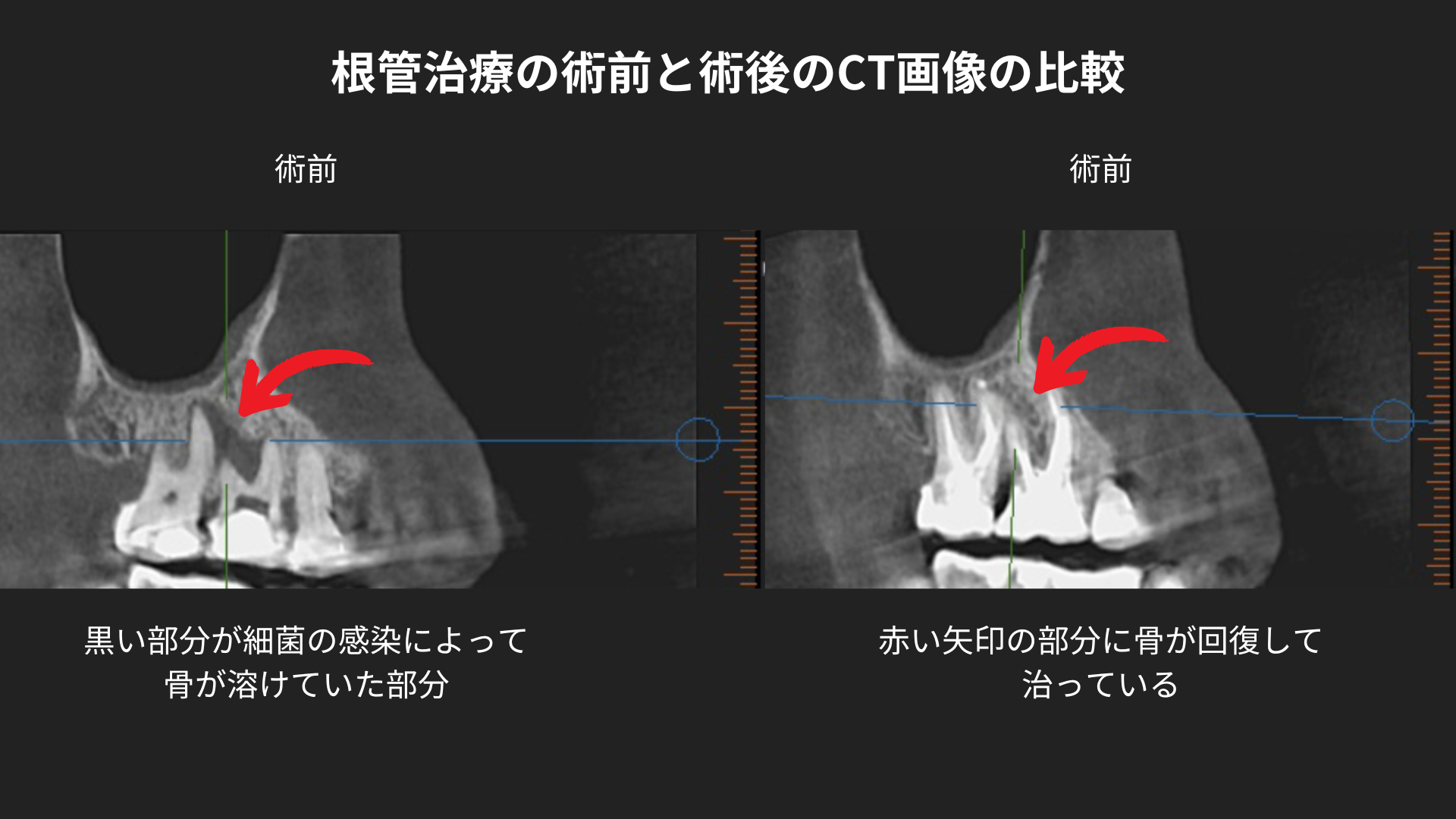 患者様の声：成功事例と感想